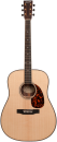 Larrivee D-60E L.R.Baggs Anthem Pickup System
